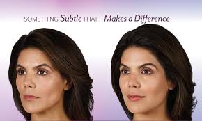 Voluma before and after