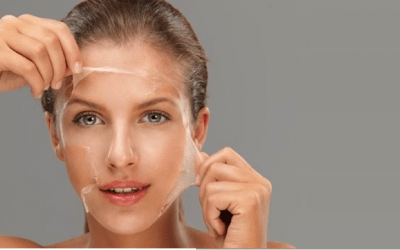 Why Fall And Winter Are The Best Time To Get A Chemical Peel