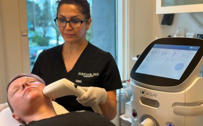 Sofwave vs. Radiofrequency Microneedling: Which is the Superior Option?