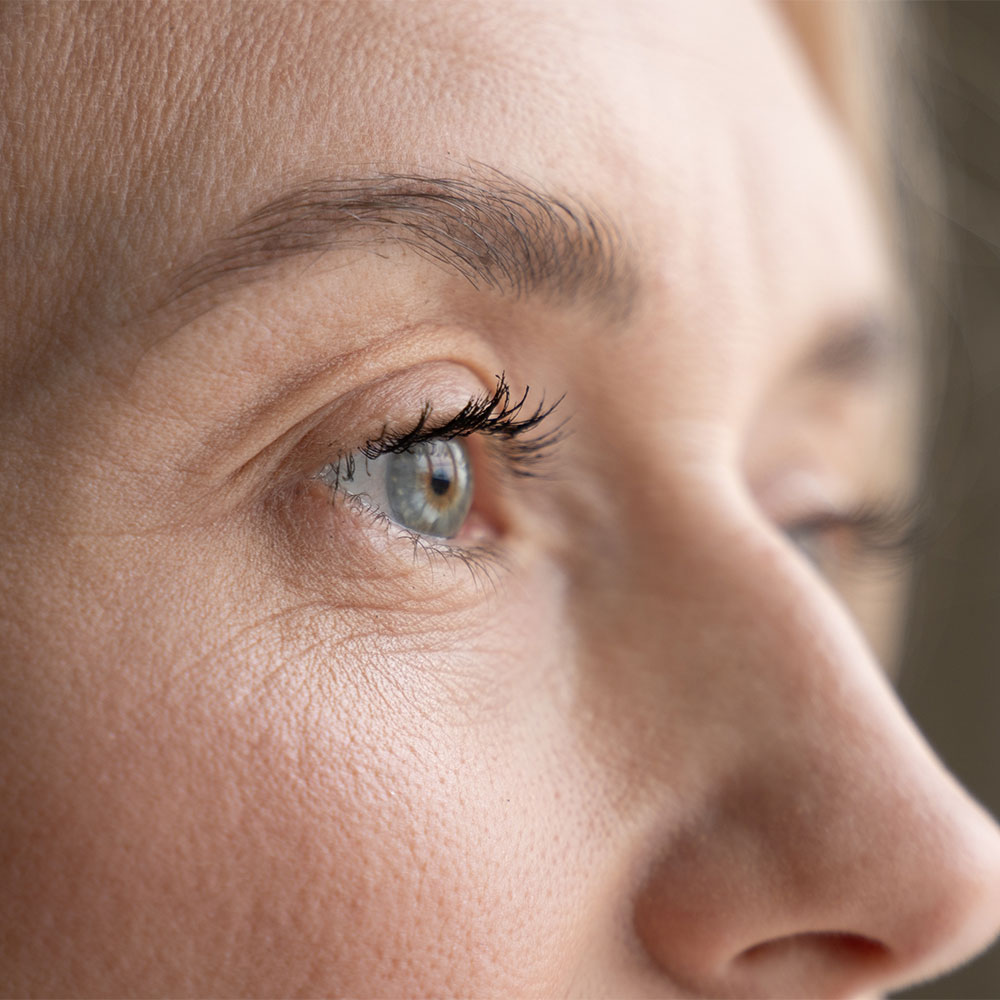 eyelid-lift-expect