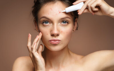 Don’t Take Acne with You to School: Start the Year with Clearer, Healthier Skin