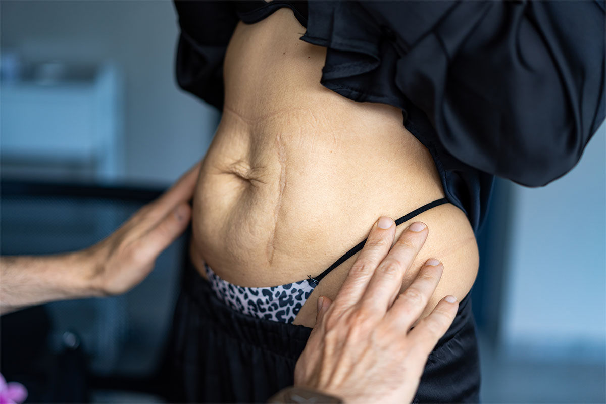 Patient Consultation at Refine Plastic Surgery Bellevue